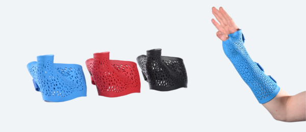 Orthèses pour la main et le poignet imprimées en 3D
