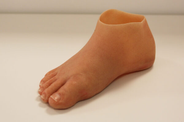 F voetprothese1